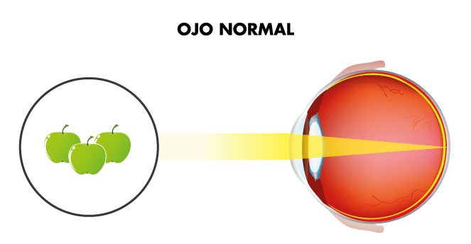 ojo-sin-vista-cansada-o-presbicia