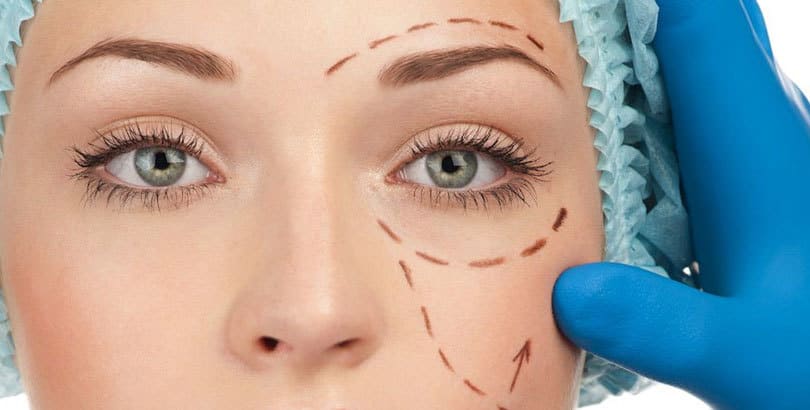 blefaroplastia postoperatorio