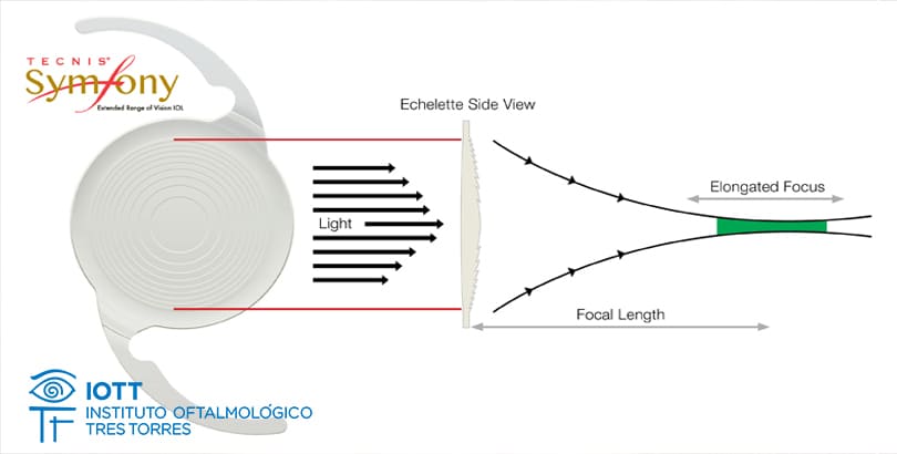 tecnis symfony multifocal