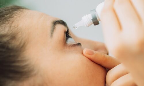 Young girl buries her eyes with special eye drops.