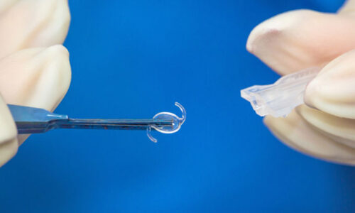 lente intraocular